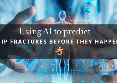 AI Hip Fracture Prediction: Tool Spots 7x More People at Risk Using Medical Records